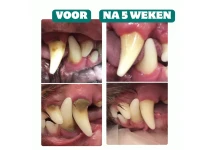 Bobiotics Frisse Adem & Gebit poeder (vleesvrij) 60 schepjes
